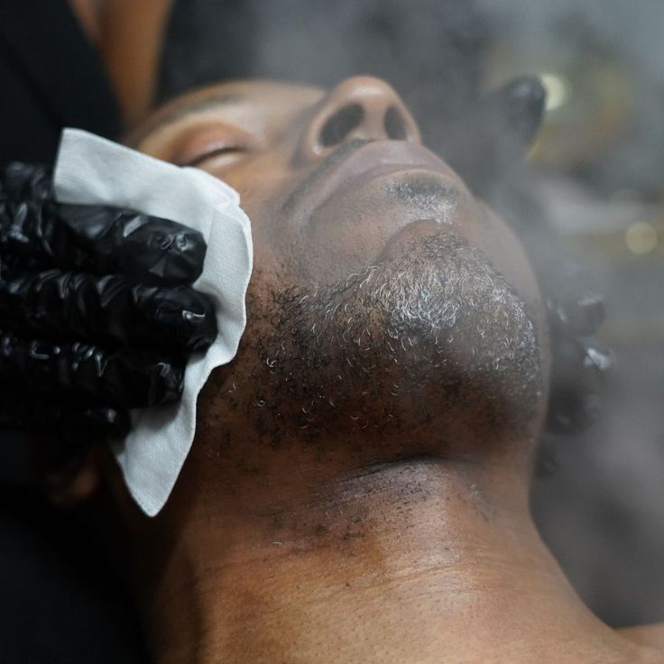 Hot towel barber treatment